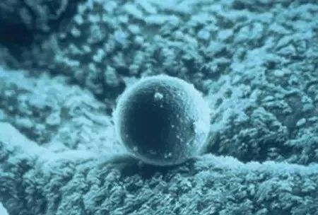 试管婴儿治疗中的卵泡发育异常