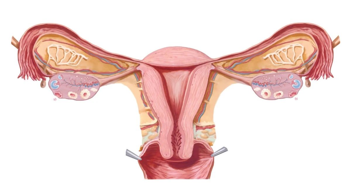 最伤子宫的6件事