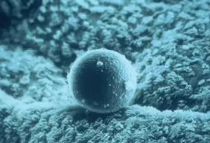 减胎，我应该留下哪个？放弃哪个？