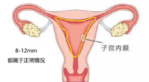打算移植了，但是子宫内膜薄怎么办？