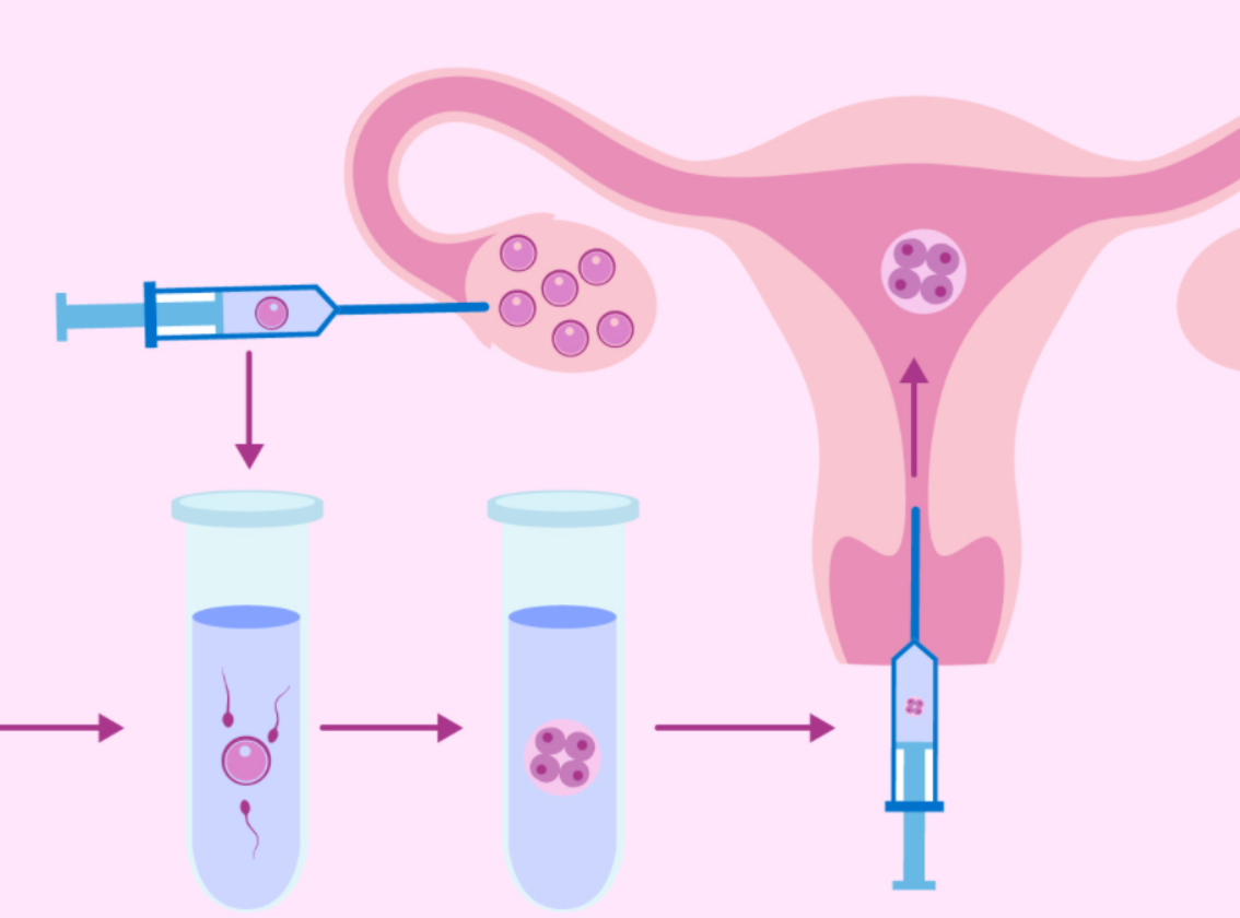 做试管不能太实诚,提高成功率还不遭罪的方法,越早知道越好!
